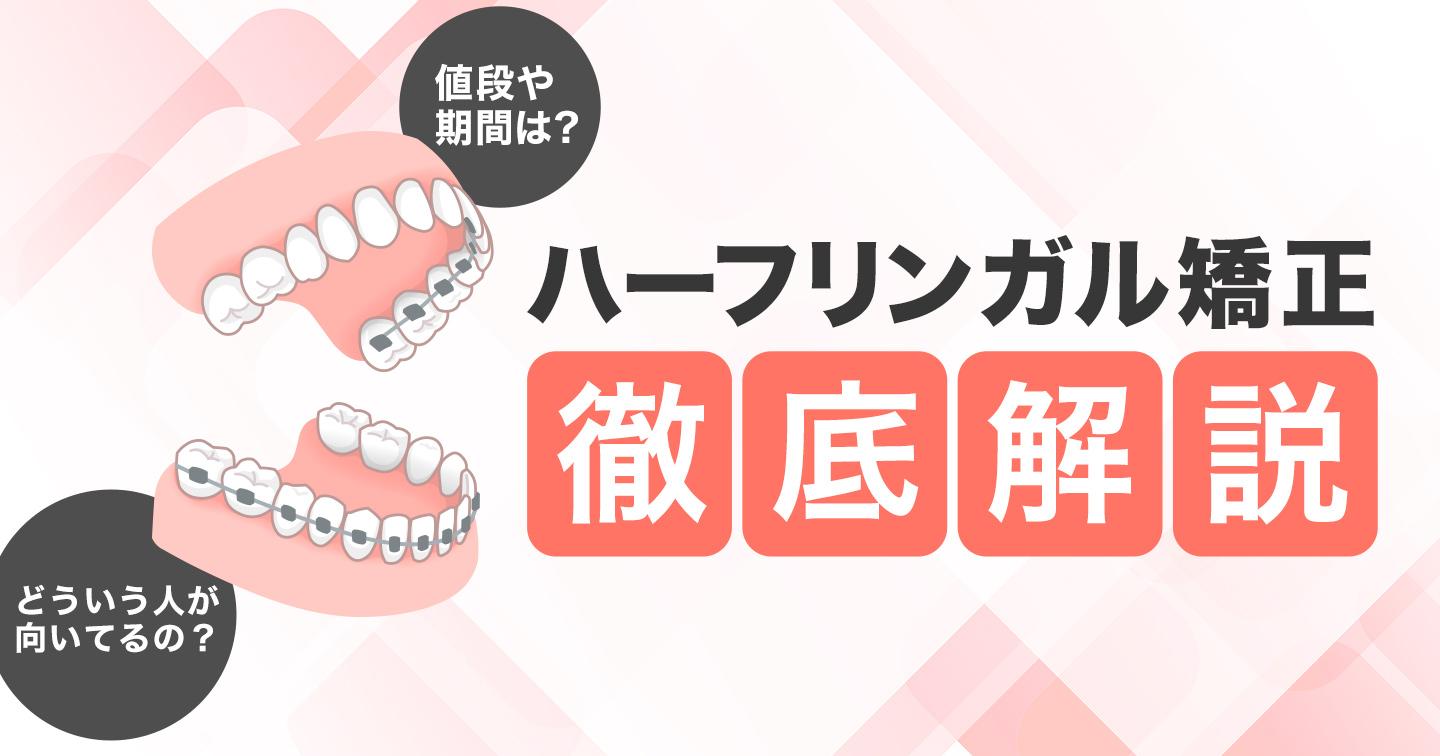 ハーフリンガル矯正 タイトル