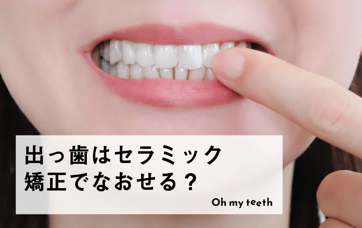 出っ歯はセラミック矯正で治せる?