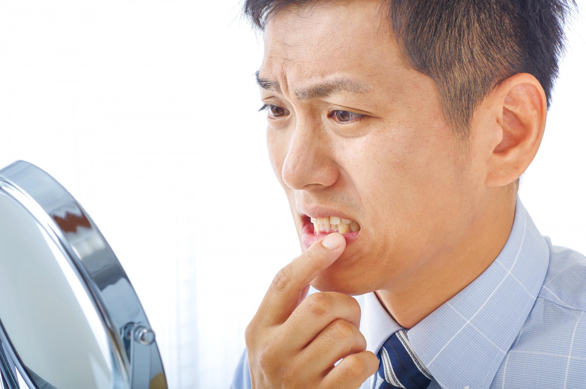 歯並びが悪い大人は何が原因?そのまま放置するとどうなる?