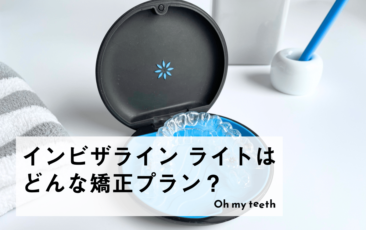 インビザライン ライトはどんな矯正プラン?