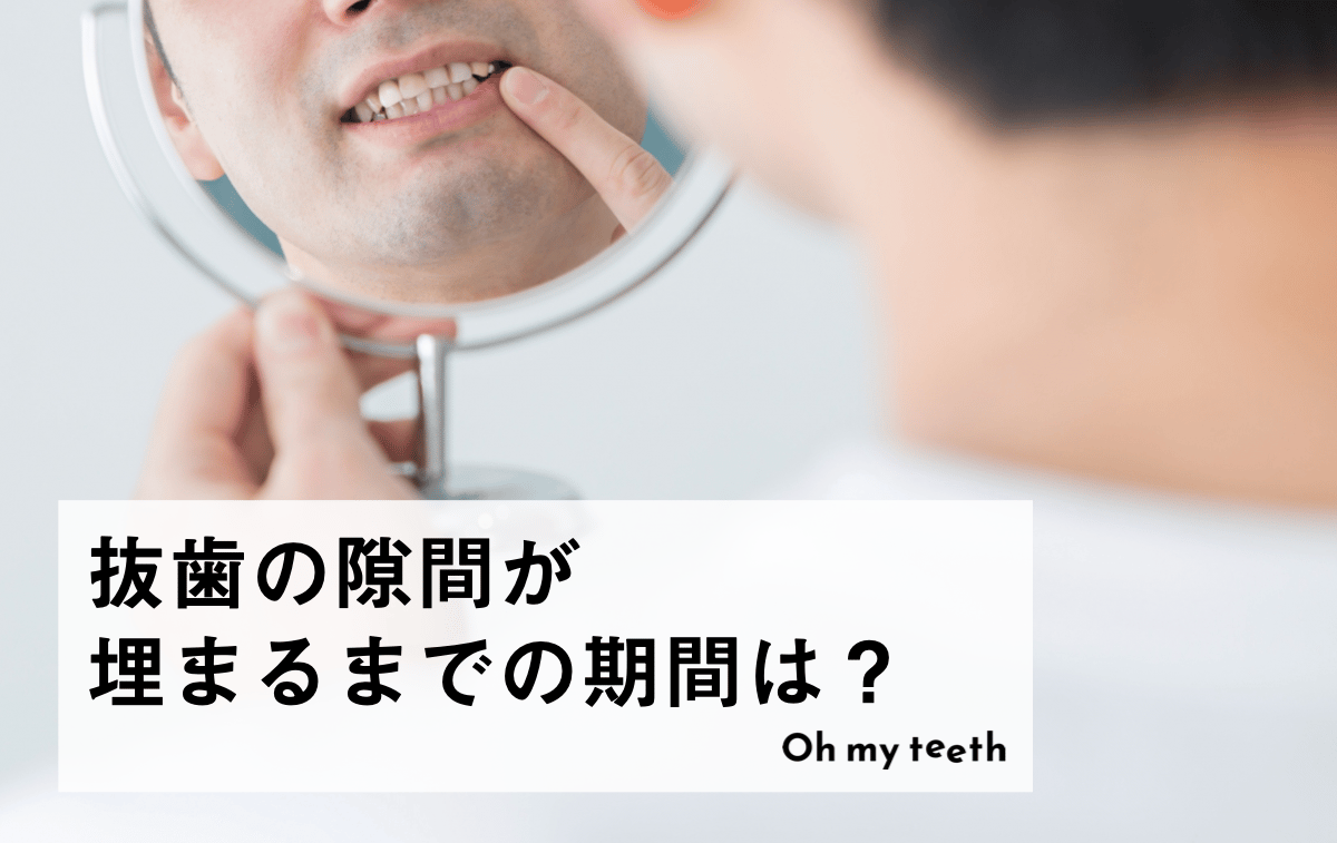 矯正で抜歯すると隙間はどれくらいで埋まる?