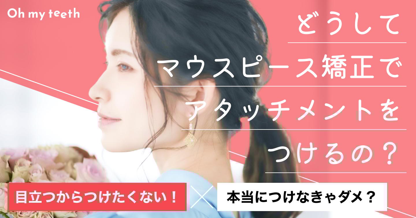 マウスピース矯正のアタッチメントとは?「目立つ」「痛い」など気になる疑問を解説