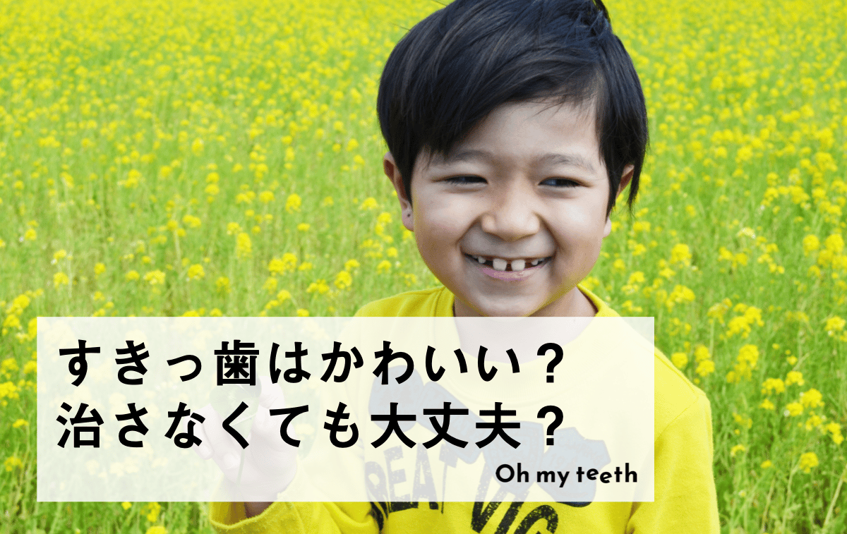 すきっ歯はかわいい?
