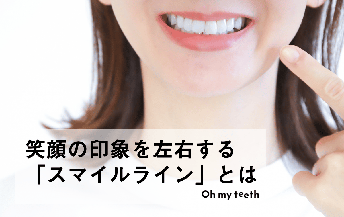 理想的なスマイルラインとは?矯正治療で改善できるのか解説