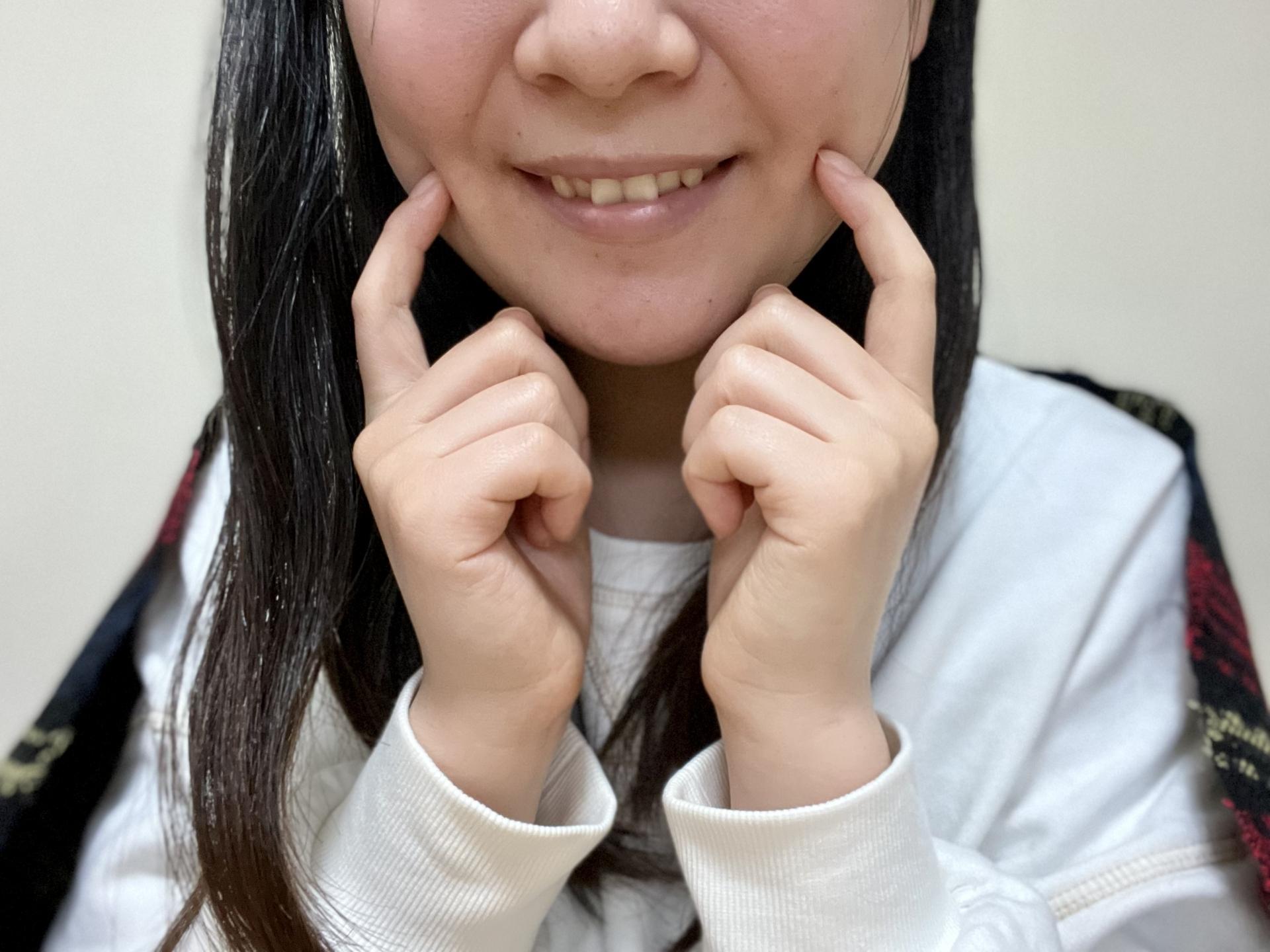 出っ歯はマウスピース矯正ができない?改善可能な例と難しい例を紹介