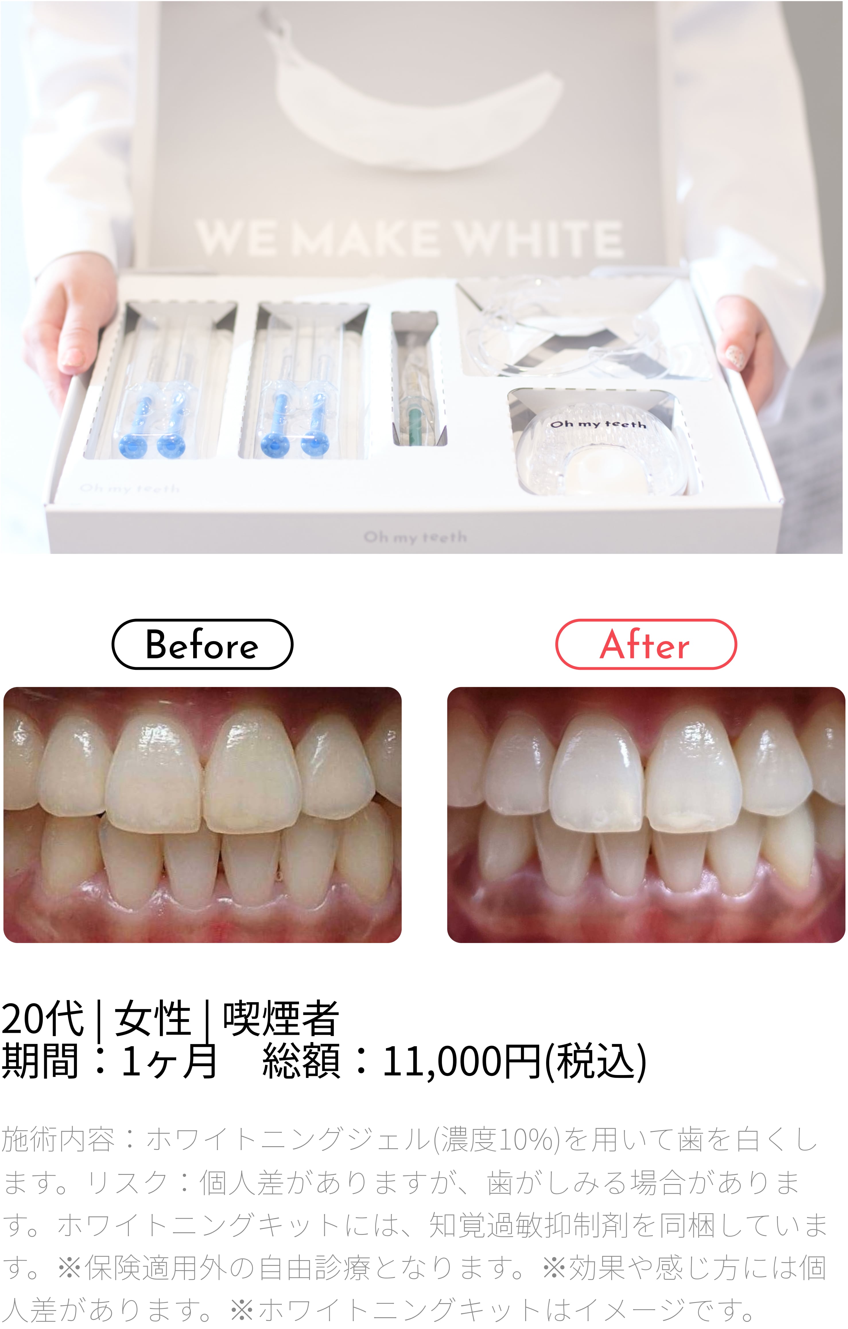 ビフォーアフター