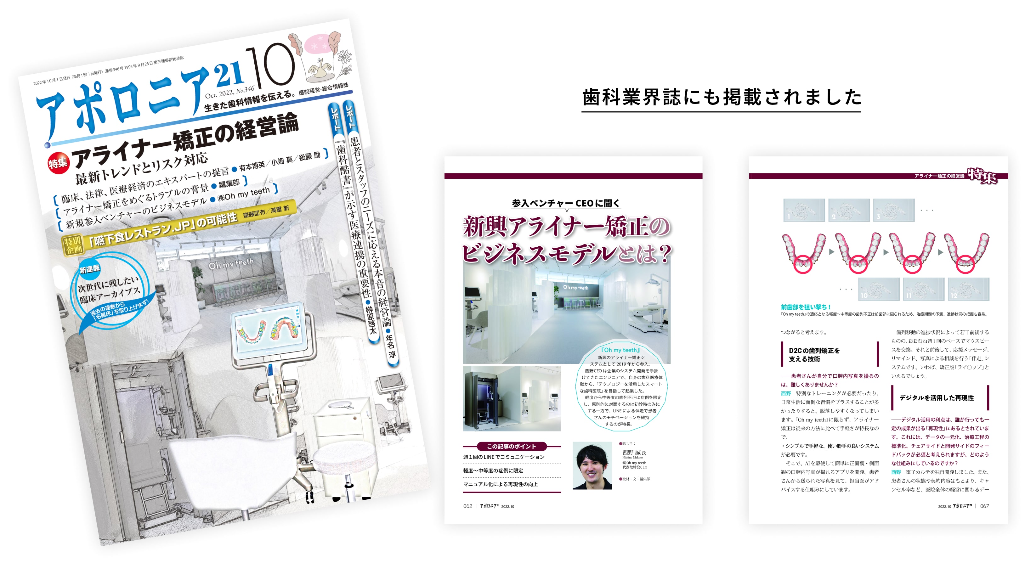 歯科業界誌にも掲載されました